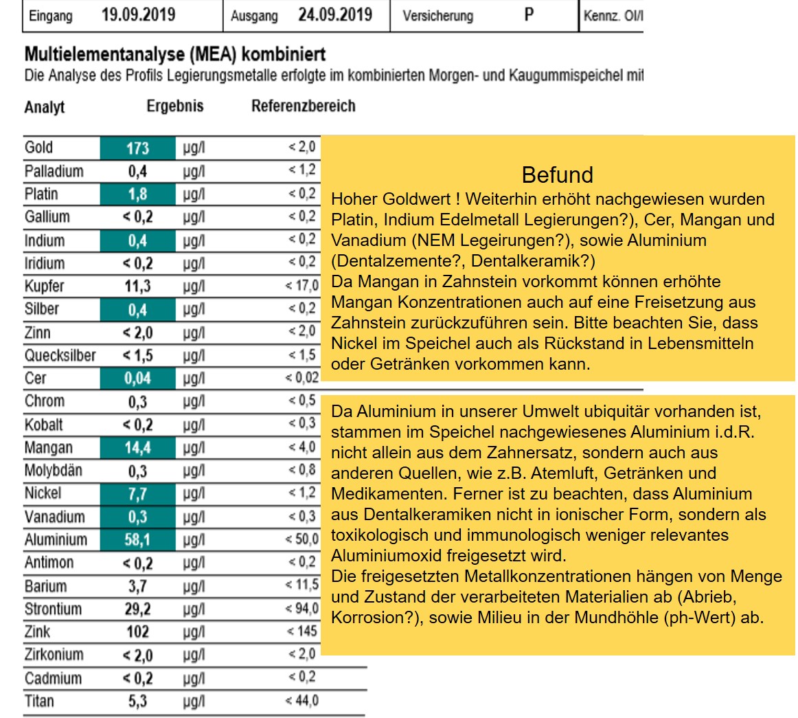 Grafik-Metalel-im-Speichel